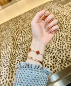 Screw Bracelet: A Symbol of Eternal Love